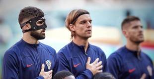 Por que alguns atletas estão jogando de máscara na Copa?