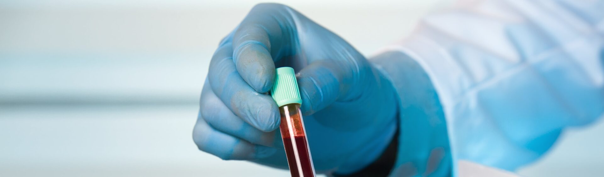 exames para vegetarianos