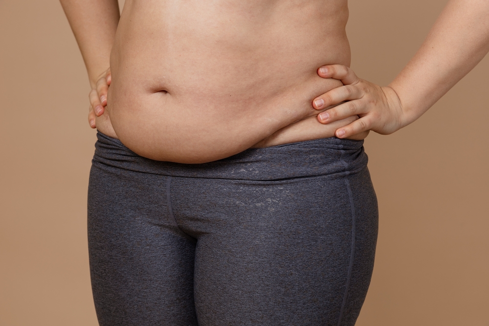 Barriga de estresse: saiba o que é e como perdê-la