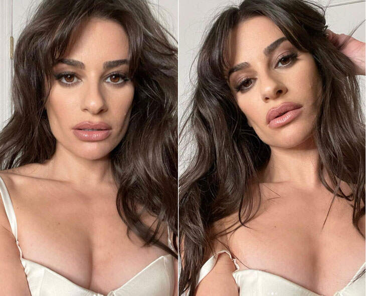 Buccal Fat Removal: entenda a nova trend do TikTok