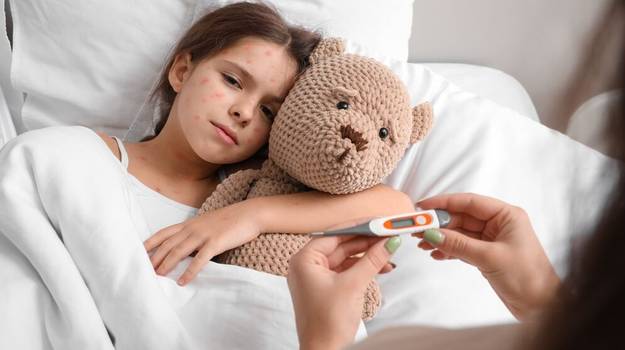 Catapora em crianças: o que é, sintomas e tratamento 