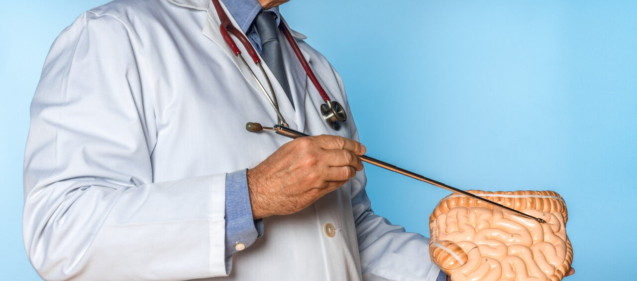 pólipos no intestino