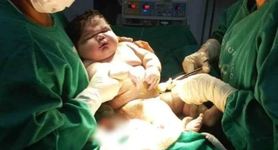 Bebê gigante nasce com 7,3 kgs no Amazonas: Entenda os riscos