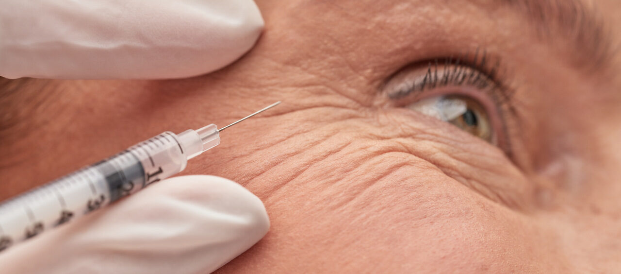 idade para harmonização facial