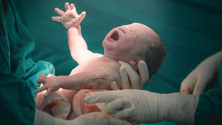 nascimento-prematuro