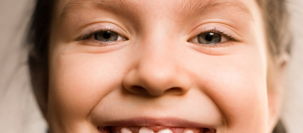 criança precisa de aparelho ortodôntico