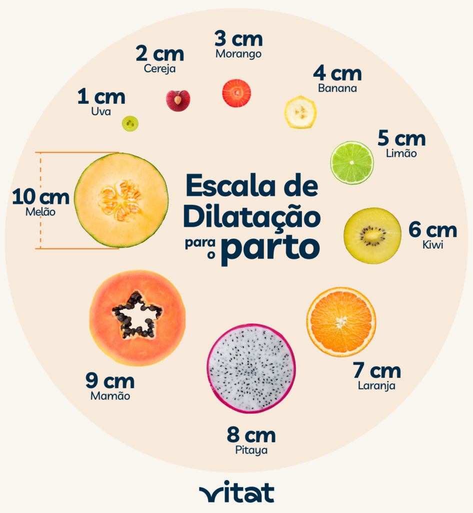 Quantos Cm De Dilatacao Precisa Para Parto Normal - FDPLEARN