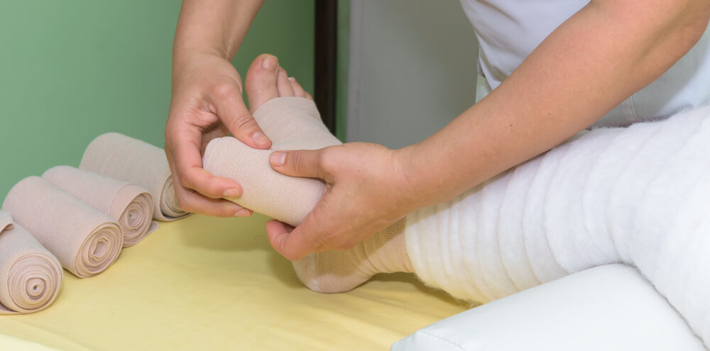 Lipoaspiração de lipedema: quando o procedimento é necessário?