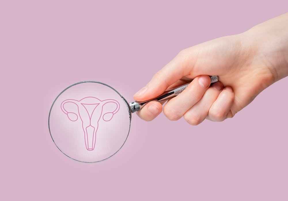 Adenomiose Ou Endometriose Saiba Identificar Os Sintomas Corretamente