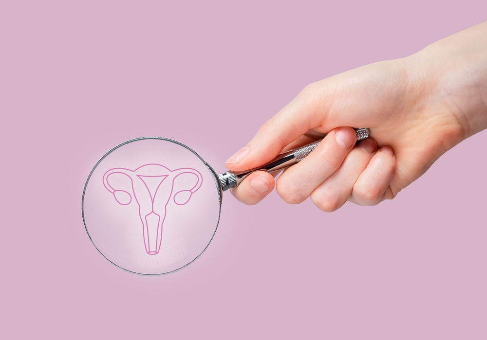 Adenomiose ou endometriose? Saiba identificar os sintomas corretamente