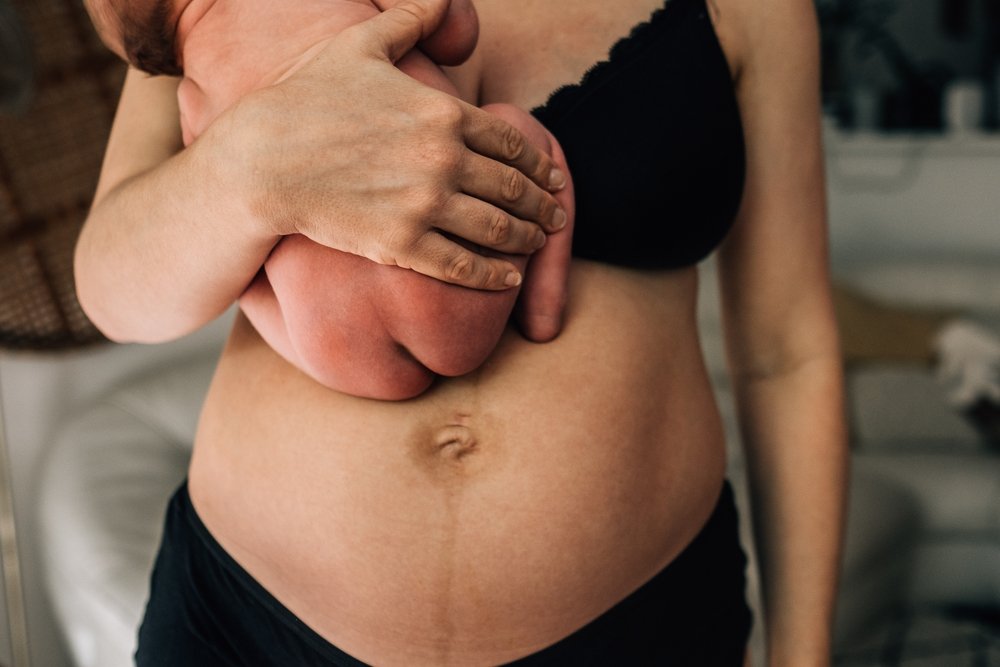 Drenagem linfática no pós parto e para cesárea
