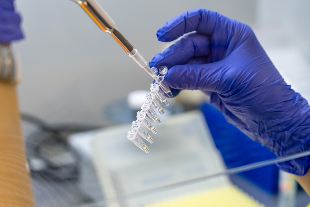 Fiocruz confirma primeira morte por influenza suína. Entenda