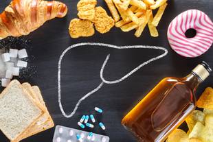 Adultos com gordura no fígado têm mais risco de desenvolver diabetes