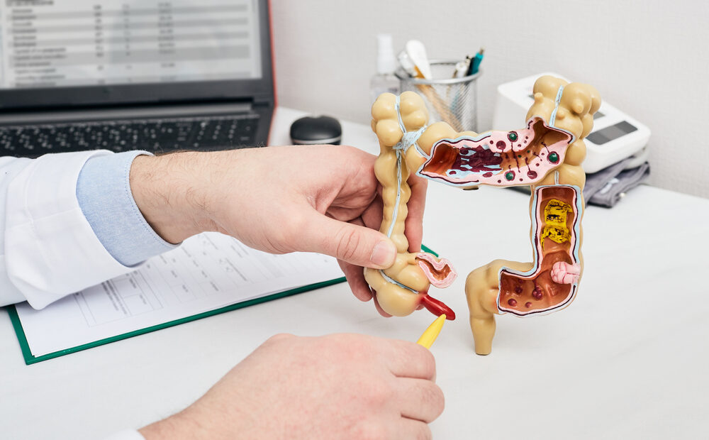 Apendicite: o que é, sintomas, causas, tratamento e mais
