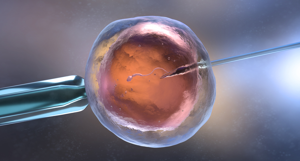 fertilização in vitro
