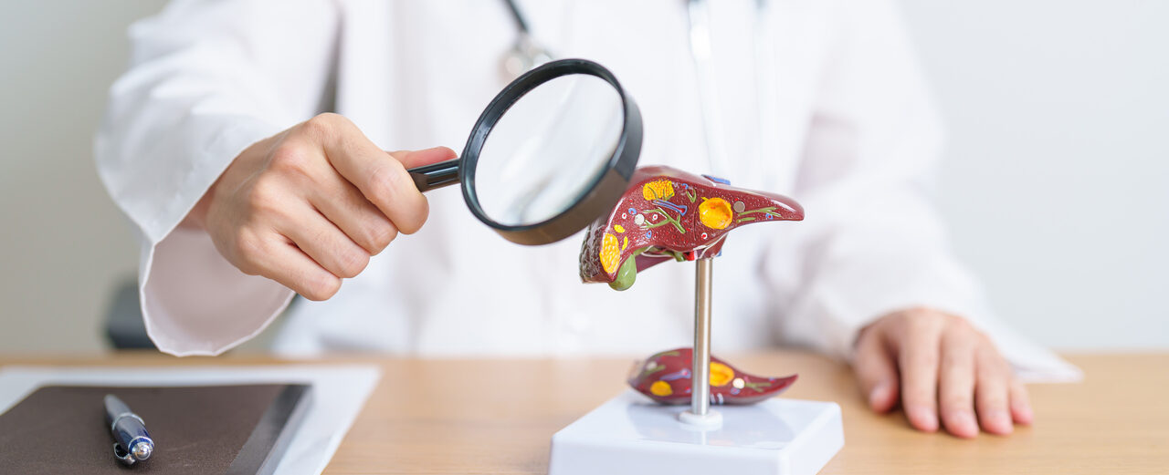 médico com uma lupa sobre uma pequena estátua em forma de fígado