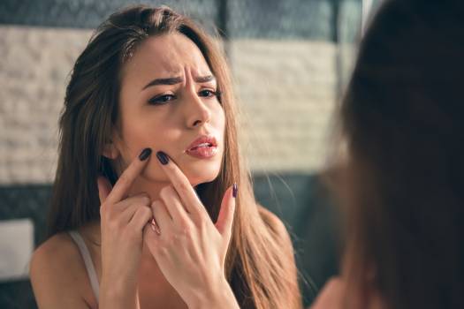 Acne e anabolizantes: quais são os riscos para a pele?