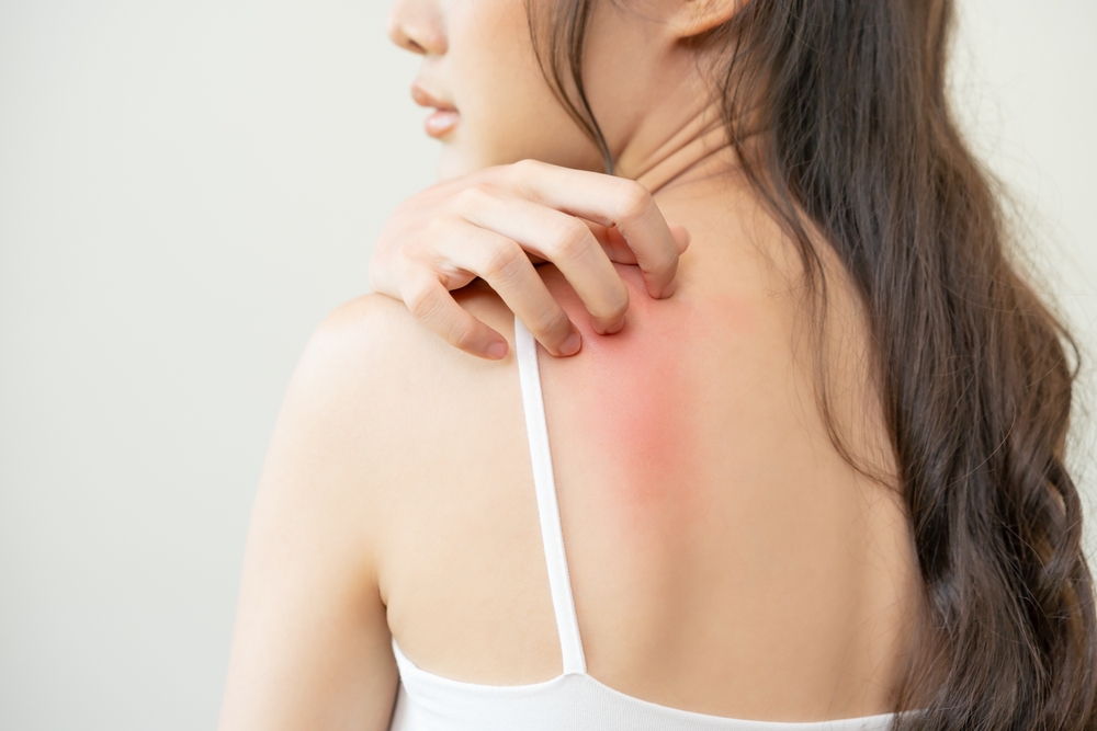 Coceira persistente pode ser sinal de notalgia parestésica. Entenda a condição