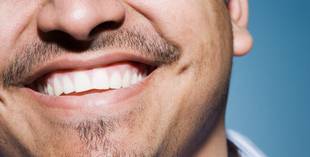 Tinta para clarear os dentes: prática é altamente nociva à saúde