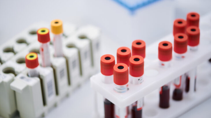 tubinhos para exame de sangue