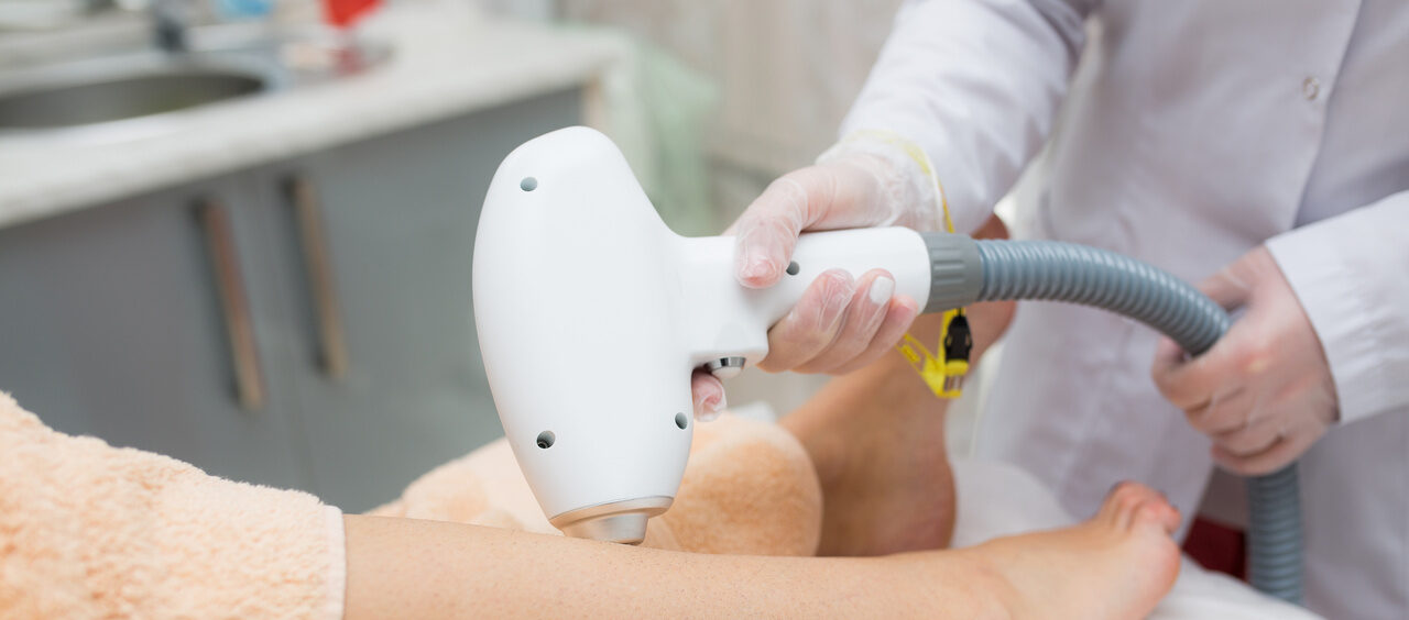 pernas de mulher recebendo depilação a laser
