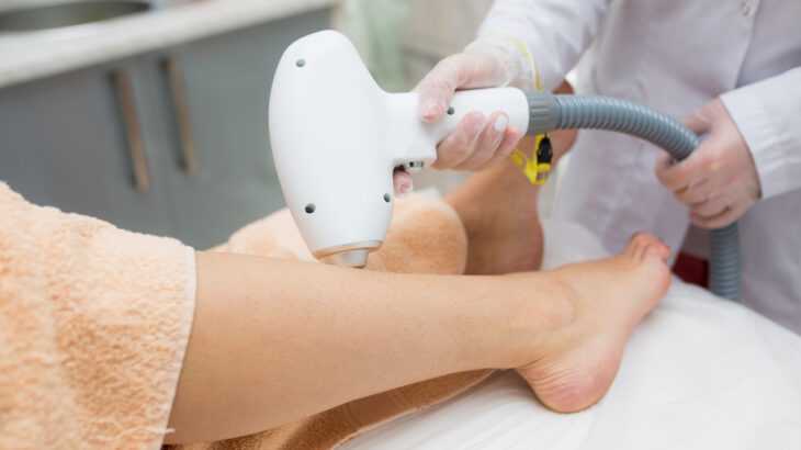 pernas de mulher recebendo depilação a laser