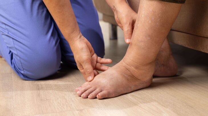 pessoa-em-consulta-avaliando-pes-diabetes